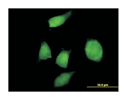 PHF17, Mouse, Purified MaxPab Polyclonal Antibody, Abnova 50&mu;g; Unlabeled:Antibodies,