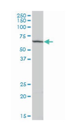 pp9099 (B01), Mouse anti-Human, Polyclonal Antibody, Abnova 50&mu;L; Unlabeled:Antibodies,
