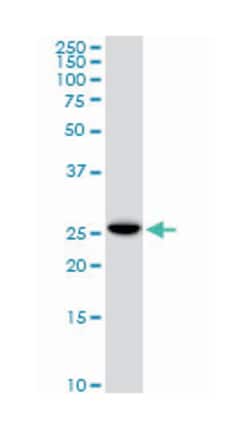 EF-hand domain family, member D1, Mouse, Clone: 1H7, Abnova 100&mu;g; Unlabeled:Antikörper
