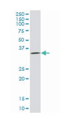ULBP2, Mouse, Purified MaxPab Polyclonal Antibody, Abnova 50&mu;g; Unlabeled:Anticuerpos