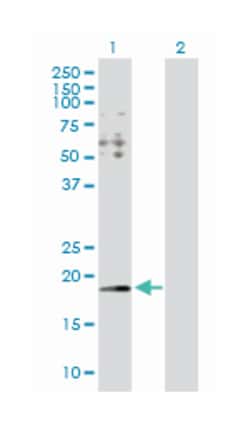 hydroxypyruvate isomerase homolog (E. coli), Rabbit, Purified MaxPab Polyclonal