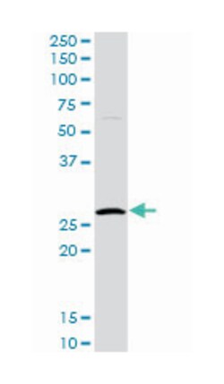 hydroxypyruvate isomerase homolog (E. coli), Rabbit, Purified MaxPab Polyclonal
