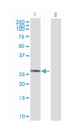 SPATA9, Mouse, Purified MaxPab Polyclonal Antibody, Abnova 50&mu;g; Unlabeled:Antibodies,