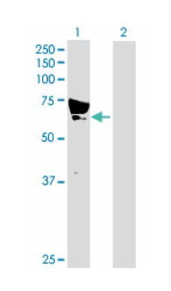 calcium/calmodulin-dependent protein kinase kinase 1, alpha, Rabbit, Purified
