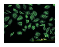 tubulin, alpha 1c, Mouse, Clone: S11, Abnova 100&mu;g; Unlabeled:Antibodies,