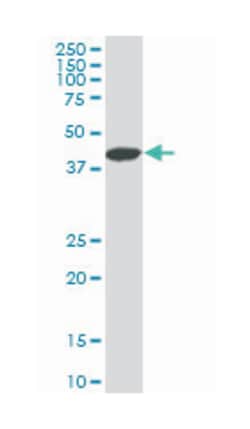 LIM homeobox 4, Mouse, Clone: 4D7, Abnova 100 &mu;g | Buy Online | Abnova | Fisher Scientific