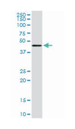 transcriptional adaptor 2 (ADA2 homolog, yeast)-beta, Mouse, Clone: 1C8,