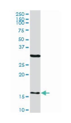 FIS1, Mouse, Clone: 1G9, Abnova 200&mu;L; Unlabeled:Antibodies, Monoclonal