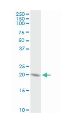 NOP16 nucleolar protein homolog (yeast), Rabbit, Purified MaxPab Polyclonal