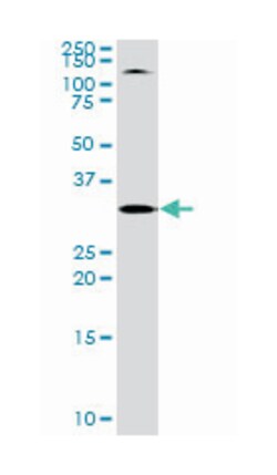 toll interacting protein, Rabbit, Purified MaxPab Polyclonal Antibody, Abnova 100 &mu;g | Buy Online | Abnova | Fisher Scientific