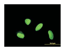 kelch domain containing 4, Mouse, Clone: 4G11, Abnova 100&mu;g; Unlabeled:Antibodies,