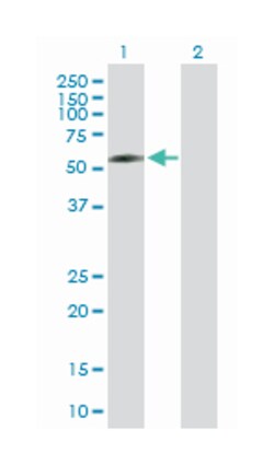 DPYSL5, Mouse, Purified MaxPab Polyclonal Antibody, Abnova 50&mu;g; Unlabeled:Antibodies,