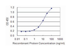 DPYSL5, Mouse, Clone: 2D10, Abnova 100&mu;g; Unlabeled:Antibodies, Monoclonal