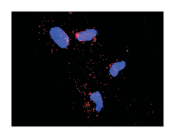SMAD specific E3 ubiquitin protein ligase 1, Rabbit, Purified MaxPab Polyclonal Antibody, Abnova 100 &mu;g | Buy Online | Abnova Corporation | Fisher Scientific