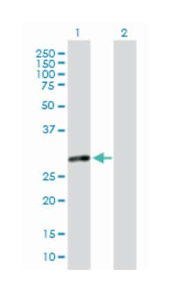 MMS19 nucleotide excision repair homolog (S. cerevisiae), Mouse, Polyclonal Antibody, Abnova 50 &mu;L | Buy Online | Abnova | Fisher Scientific