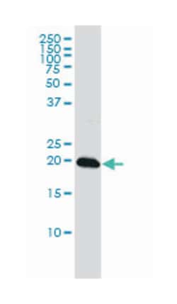 centromere protein M, Mouse, Clone: 4C12-2C8, Abnova 100&mu;g; Unlabeled:Antibodies,