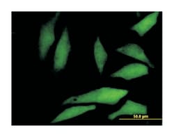 WD repeat domain 77, Mouse, Polyclonal Antibody, Abnova 50&mu;L; Unlabeled:Antibodies,
