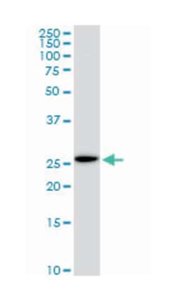 EF-hand domain family, member D1, Mouse, Clone: 1H7, Abnova 100&mu;g; Unlabeled:Antikörper