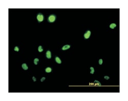 testis-specific serine kinase 1B, Mouse, Clone: 2E8, Abnova 100&mu;g; Unlabeled:Antibodies,