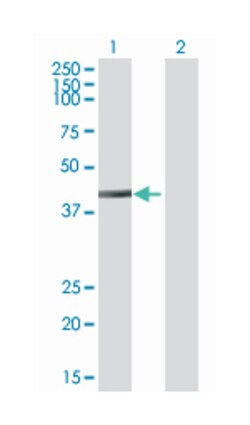 Hermansky-Pudlak syndrome 3, Mouse, Polyclonal Antibody, Abnova 50&mu;L;