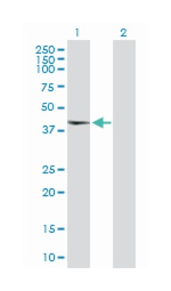 TAF5-like RNA polymerase II, p300/CBP-associated factor (PCAF)-associated factor, 65kDa, Rabbit, Purified MaxPab Polyclonal Antibody, Abnova 100 &mu;g | Buy Online | Abnova | Fisher Scientific