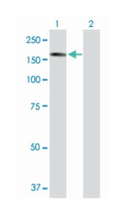 serine/threonine kinase 36, fused homolog (Drosophila), Mouse, Purified
