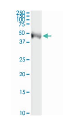 tektin 2 (testicular), Mouse, Clone: 2H4, Abnova 100&mu;g; Unlabeled:Antibodies,