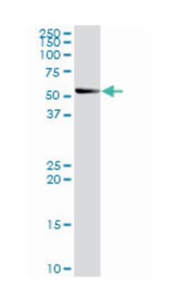 sphingomyelin phosphodiesterase, acid-like 3B, Rabbit, Purified MaxPab