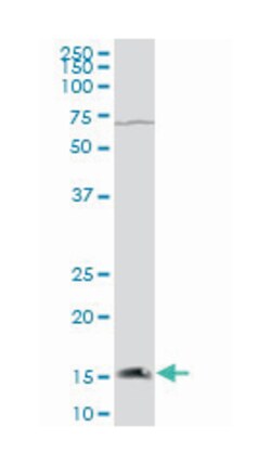 CGRP receptor component, Mouse, Polyclonal Antibody, Abnova 50&mu;L; Unlabeled:Antibodies,