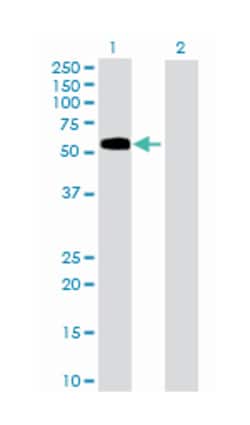 feline leukemia virus subgroup C cellular receptor 1, Mouse, Polyclonal