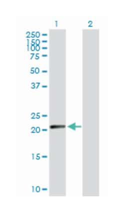 N-6 adenine-specific DNA methyltransferase 1 (putative), Rabbit, Purified