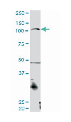 catenin (cadherin-associated protein), alpha 3, Rabbit, Purified MaxPab