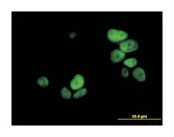 ubiquitin-like with PHD and ring finger domains 1, Mouse, Clone: 3B12,