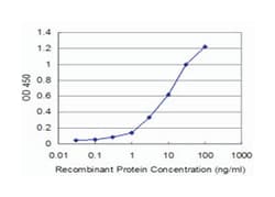 ubiquitin-like with PHD and ring finger domains 1, Mouse, Clone: 3B12,