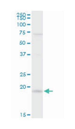 interleukin 21, Rabbit, Purified MaxPab Polyclonal Antibody, Abnova 100&mu;g;