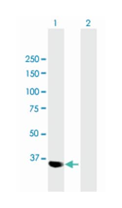 parvin, gamma, Mouse, Polyclonal Antibody, Abnova 50&mu;L; Unlabeled:Antibodies,