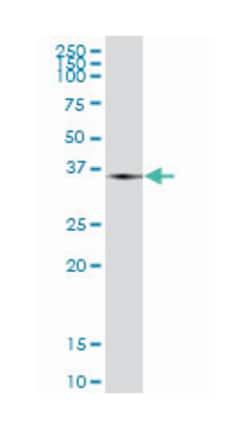 THOC3, Mouse, Polyclonal Antibody, Abnova 50 &mu;g | Buy Online | Abnova Corporation | Fisher Scientific