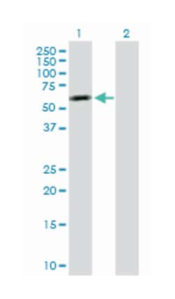 tensin 4, Rabbit, Purified MaxPab Polyclonal Antibody, Abnova 100&mu;g;