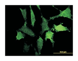 signal-regulatory protein alpha, Mouse, Clone: 4C7, Abnova 100&mu;g; Unlabeled:Antibodies,