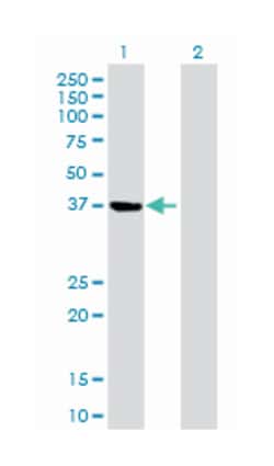 phosphoserine aminotransferase 1, Mouse, Purified MaxPab&trade; Polyclonal Antibody, Abnova&trade;