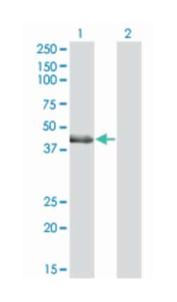LIM and cysteine-rich domains 1 (A01), Mouse anti-Human, Polyclonal Antibody,