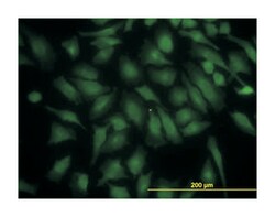 phosphoinositide-3-kinase, regulatory subunit 4, Mouse, Clone: 1B5, Abnova&trade;