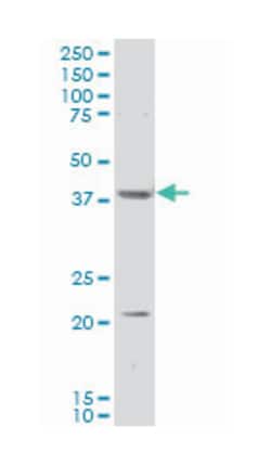 par-6 partitioning defective 6 homolog alpha (C. elegans) (A01), Mouse