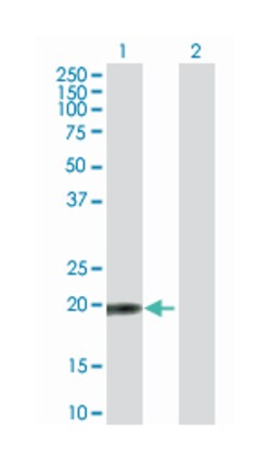 TP53RK binding protein, Mouse, Purified MaxPab™ Polyclonal Antibody, Abnova™