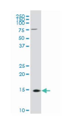 fission 1 (mitochondrial outer membrane) homolog (S. cerevisiae), Mouse,