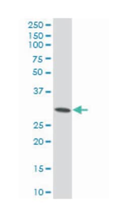hydroxysteroid (17-beta) dehydrogenase 12 (A01), Mouse anti-Human, Polyclonal