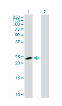 NOP16 nucleolar protein homolog (yeast), Rabbit, Purified MaxPab Polyclonal