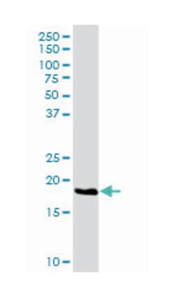 NOP16 nucleolar protein homolog (yeast), Rabbit, Purified MaxPab Polyclonal
