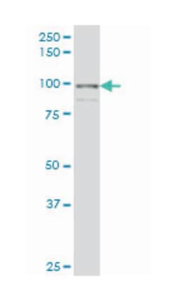 transportin 2, Mouse, Polyclonal Antibody, Abnova&trade;
