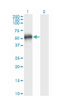 EFEMP2, Mouse, Clone: 2C8, Abnova 100&mu;g; Unlabeled:Antibodies, Monoclonal